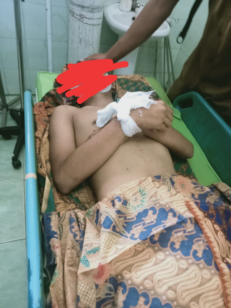 Tragedi Berdarah,Siswa SMPN 20 Sungai Tebal Merangin Tewas Ditikam Teman Dikelasnya