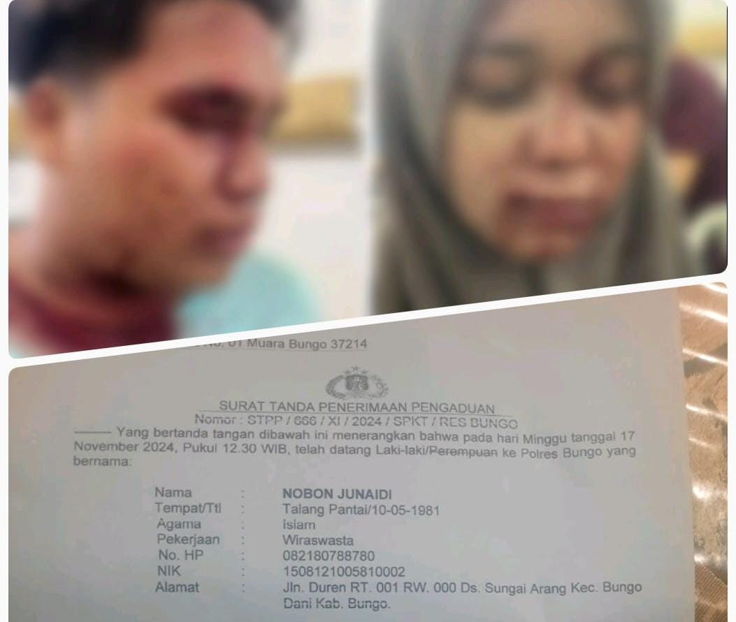 Pendukung 01 Yang Jadi Korban Kekerasan Saat Debat Lapor Ke Polres Bungo